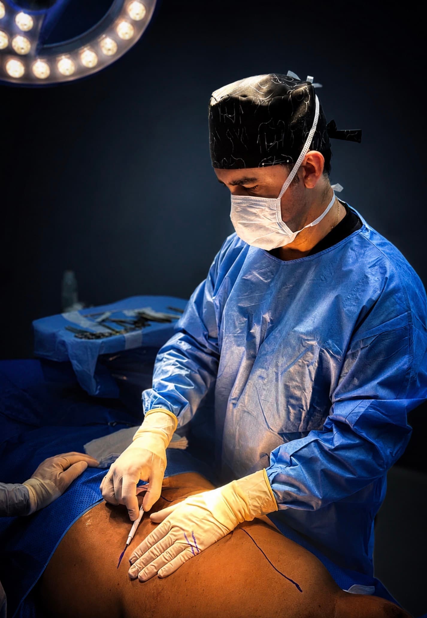 Plastic surgeon making surgical markings in the operating room