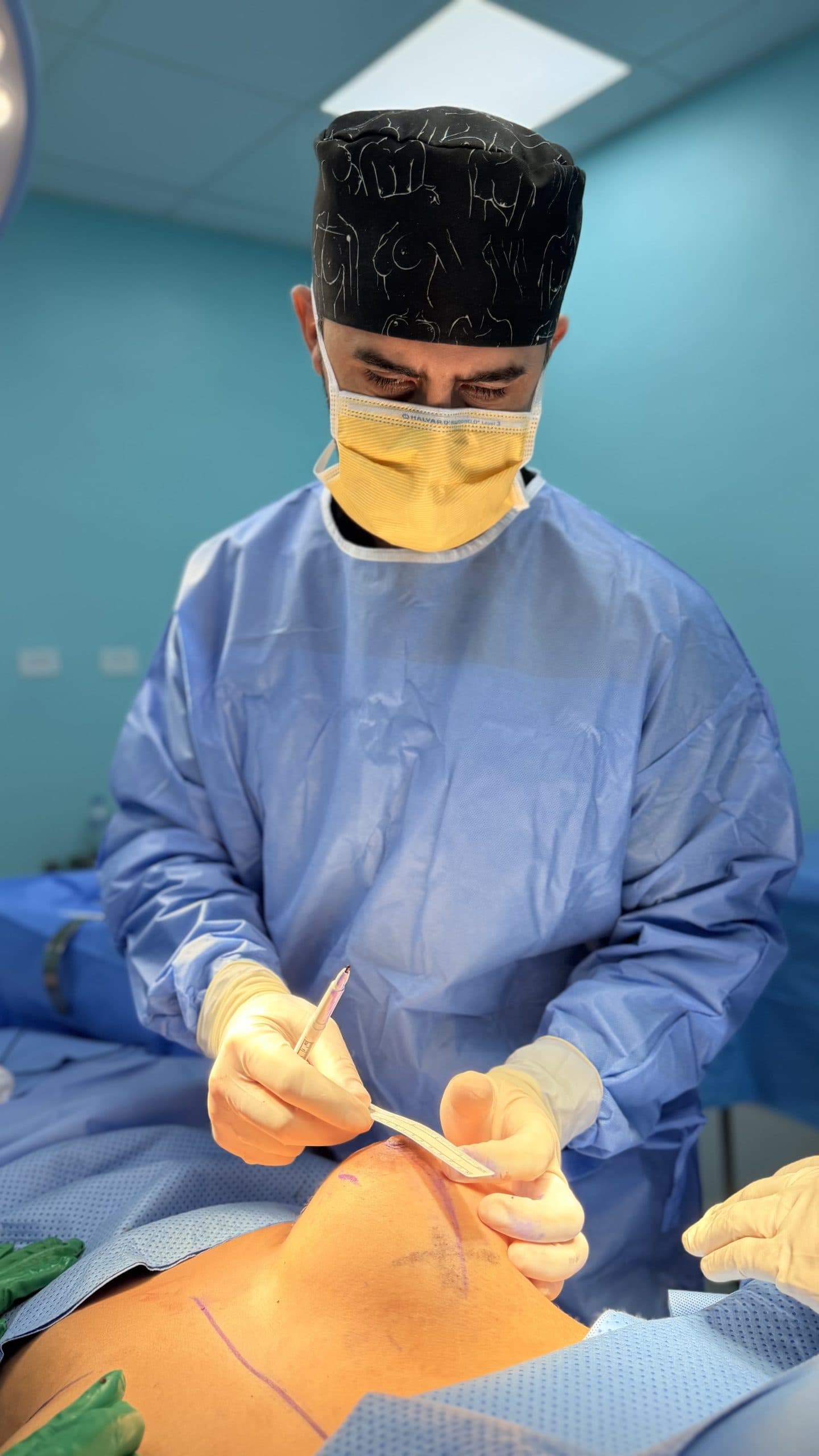 Plastic surgeon making surgical markings during a procedure